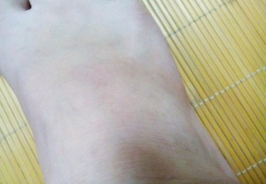 上体育课是不慎扭到脚