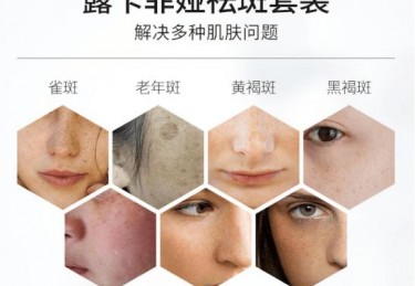 专家推荐：淡斑产品排行榜10强